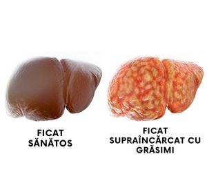 Ce toxine dăunează ficatului